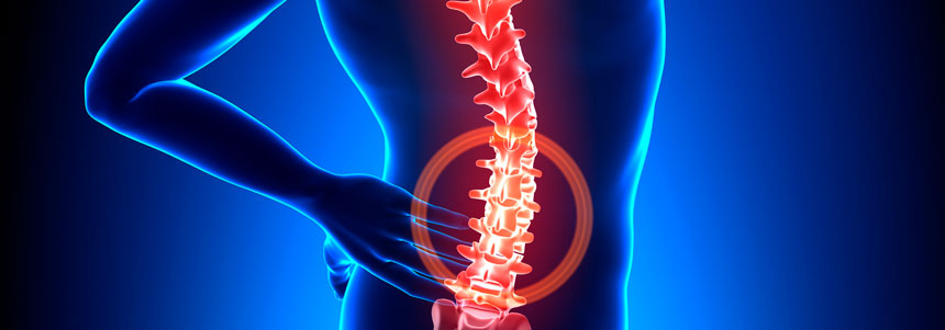 Pilates-para-escoliose