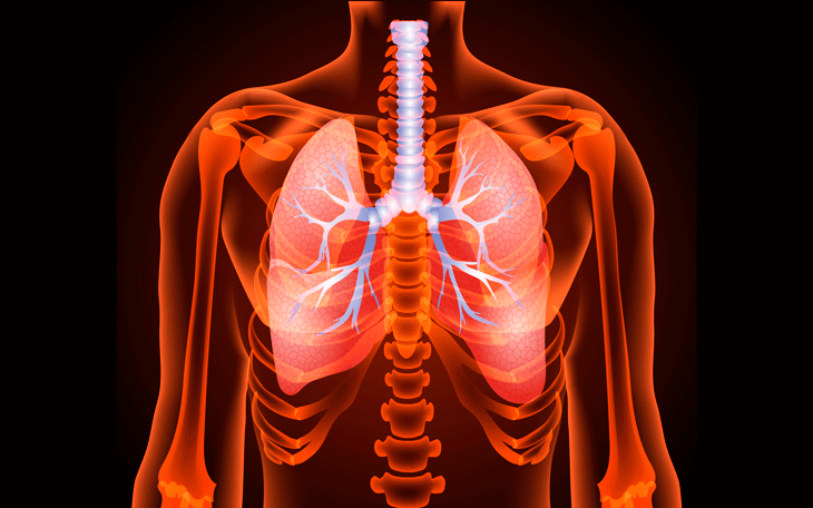 Doença Pulmonar Obstrutiva Crônica: como podemos tratá-la com Pilates?
