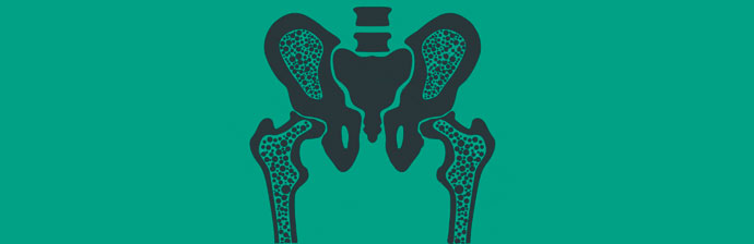 Osteoporose-2