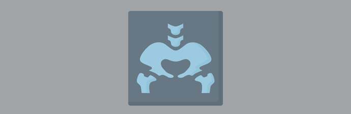 Pilates-no-Tratamento-da-Pubalgia-33