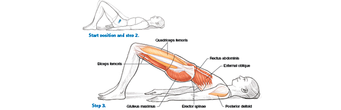 Posso agachar com Dor Lombar Crônica? - Blog Pilates - O maior blog de  Pilates do Brasil