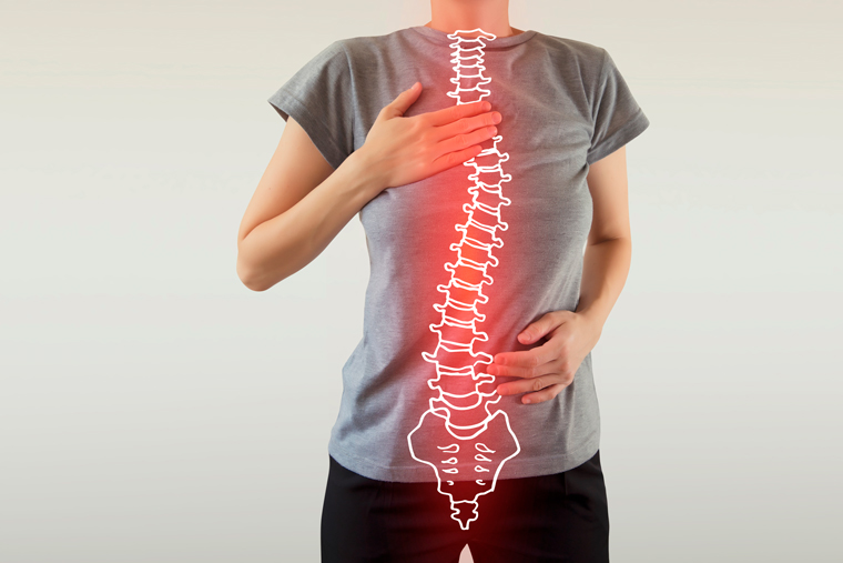 musculação #escoliose #escoliosis #coluna #colunavertebral