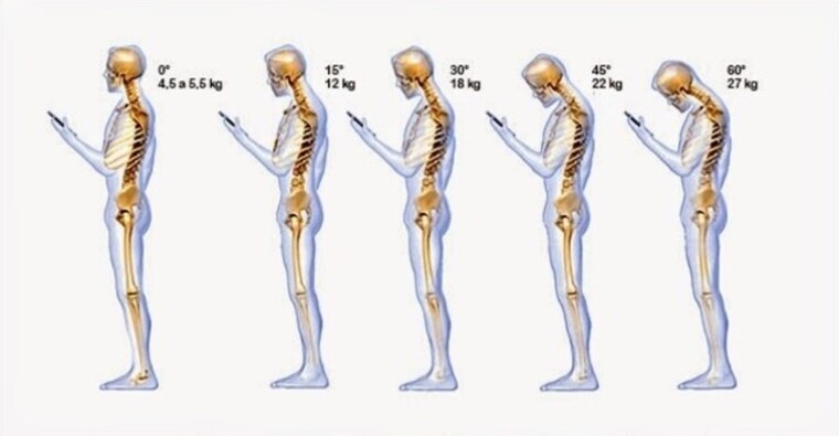 Pilates para a cervicalgia Como o Método auxilia no tratamento