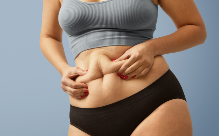 O que é diástase abdominal e como tratar?