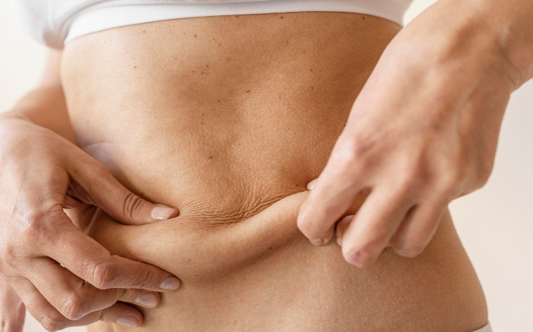 O que é abdominoplastia e como o Pilates ajuda no pós-operatório?