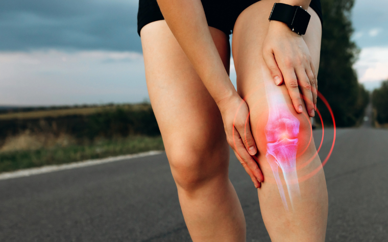 Abordagem do Método Pilates no tratamento de pacientes com artrose de joelho