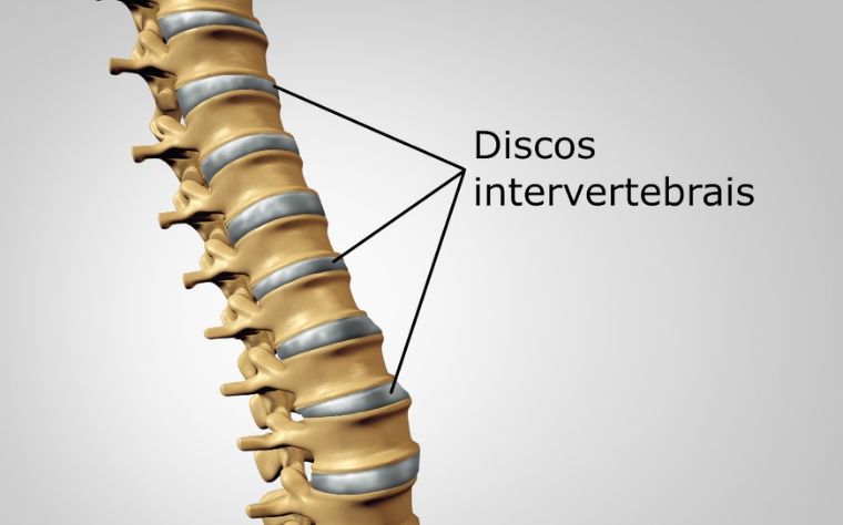 discos-intervertebrais